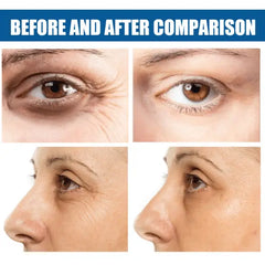Anti-Aging Collagen Eye Mask - Reduces Dark Circles and Fine Lines Doba
